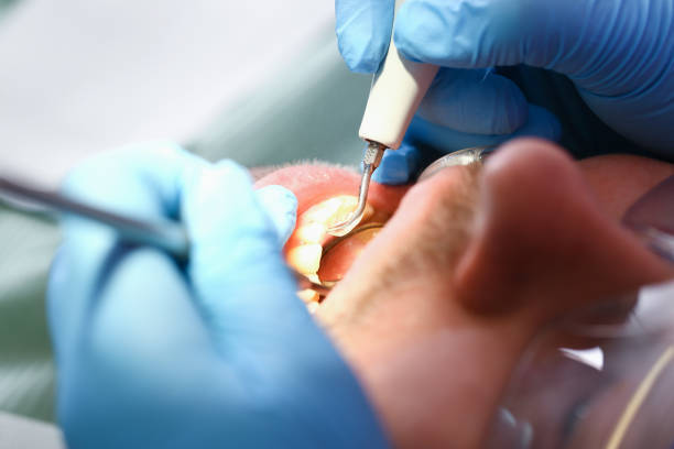 Best Emergency Dental Services for Seniors in Clymer, PA