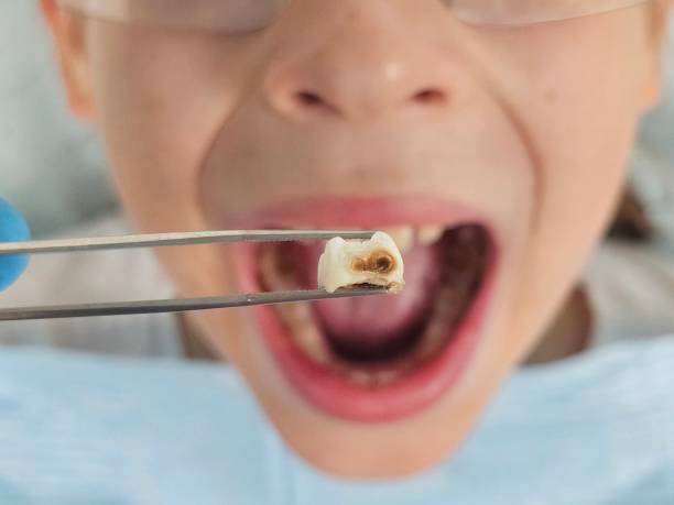 Best Pediatric Emergency Dentist in Clymer, PA